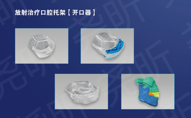 放射治疗定位装置——定制式口腔托架